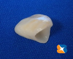 オールセラミック　80,000円