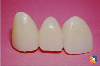 保険の３連結ブリッジ