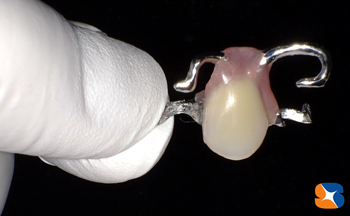 当院のデザイン入れ歯