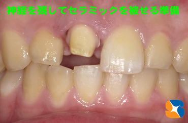 形を作り、パソコンに読み込み、その日に完成