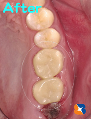 出国２日前にギリギリ完成