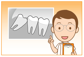 歯専用の最新CT器機