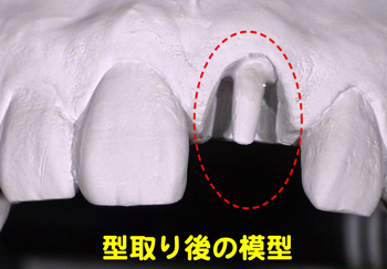 セレックを使って製作