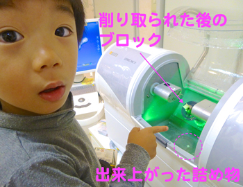 厚労省指定　最先端医療機器　セレック