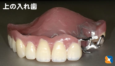 安定感のある薄い入れ歯　見た目も良い