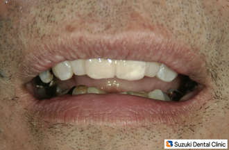 喜んで下さった患者様