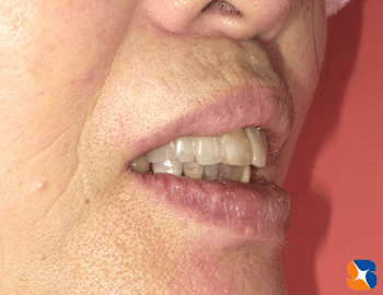 別人のような口元に変身