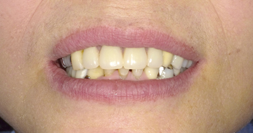 キレイな歯並びに風変わり