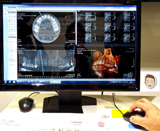 パソコンで歯の形状や骨量を診査