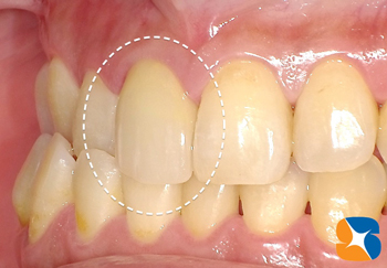 ドクターが技工士にチェンジ