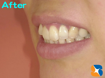 とても笑顔のステキな女性に変わりました