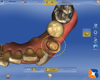 パソコンに取り込んだ拡大画像で精密性を評価