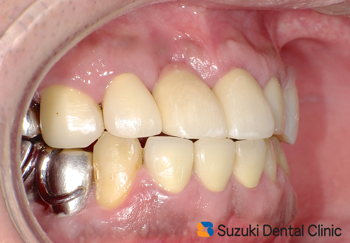 大満足の患者様