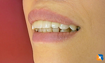 自然な感じの口元