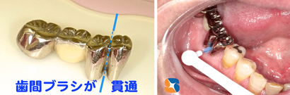 特殊なブリッジのメンテナンス