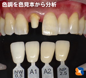 多彩な色見本で自然なセラミックを製作する