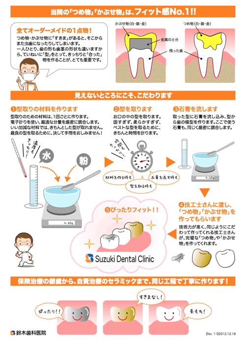 ベストの準備とベストの材料で最高の仕上げ