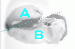 口の中で歯の根を２分割
