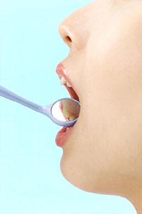 歯の治療と管理