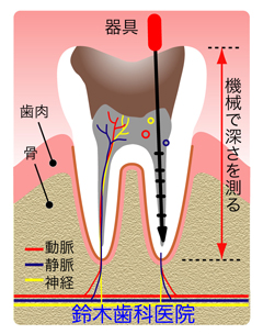 歯の構造イラスト